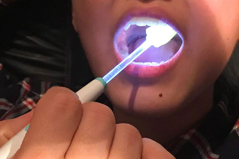 光る歯ブラシ ピカスポ 使用例