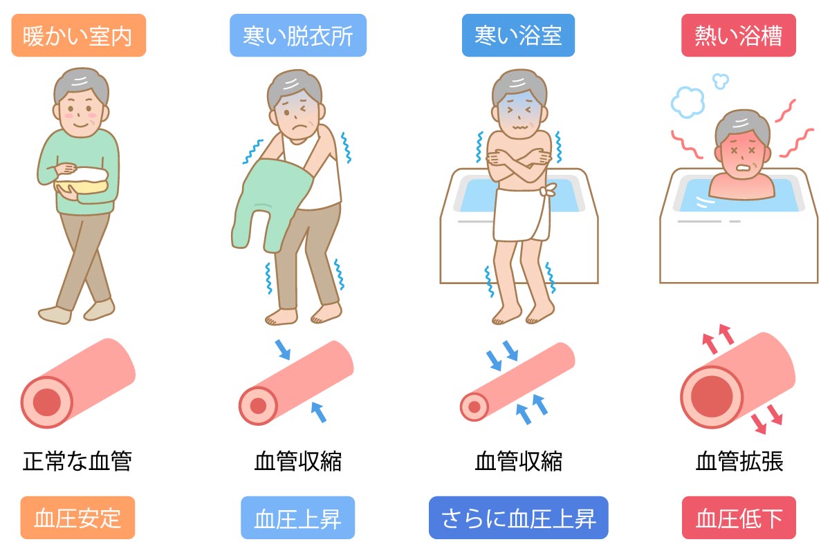 ヒートショックが起こるメカニズムイメージ